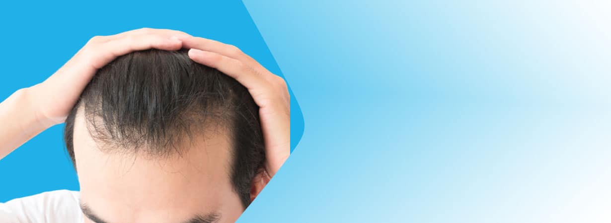 Hair Transplant Cost in Jaipur.
