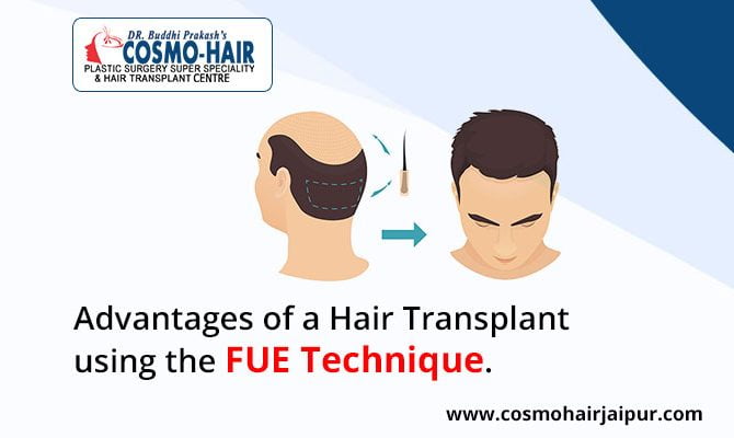 Advantages of a hair transplant using the FUE technique