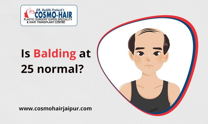 Is balding at 25 normal?
