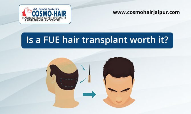 Is FUE hair transplant worth it?