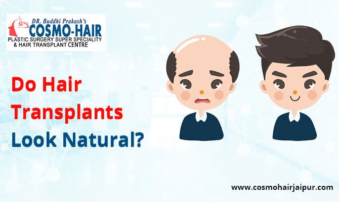 Do hair transplants look natural?