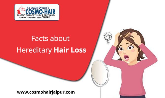 Facts About Hereditary Hair Loss