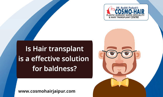 Is Hair transplant effective solution for baldness?