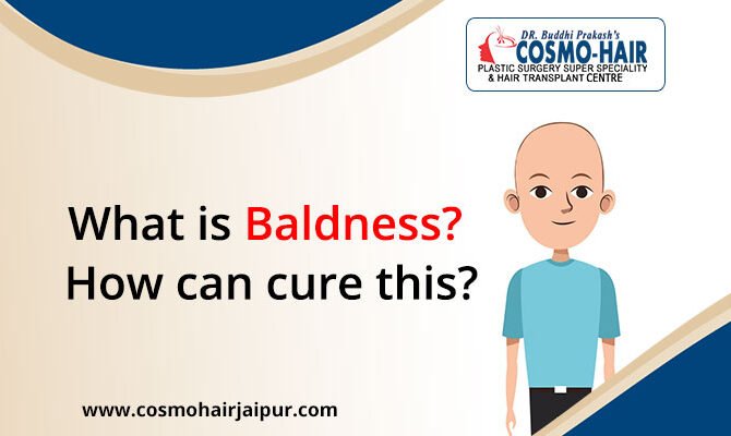 What is Baldness? How can cure this?