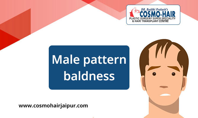 Male pattern baldness