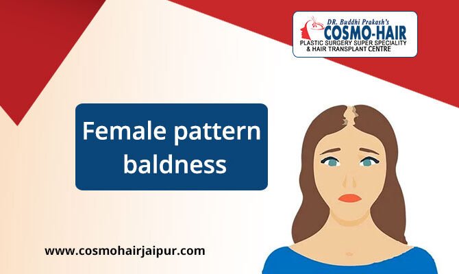 Female pattern baldness