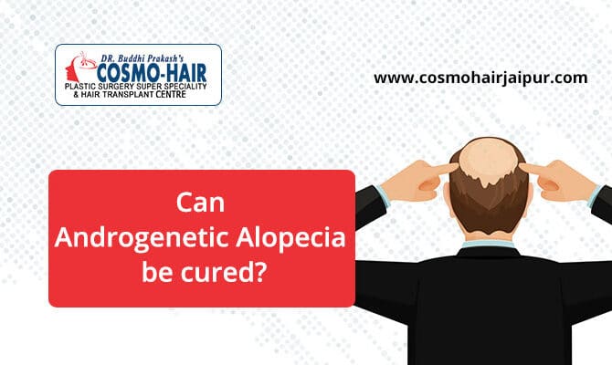 Can Androgenetic Alopecia Be Cured?