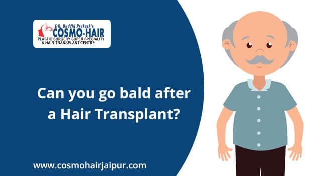 Can we bald after hair transplantation?