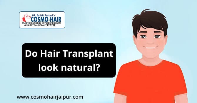 Do hair transplant look natural?
