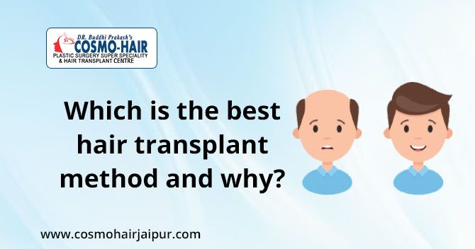 Which is the best method of hair transplantation and why?