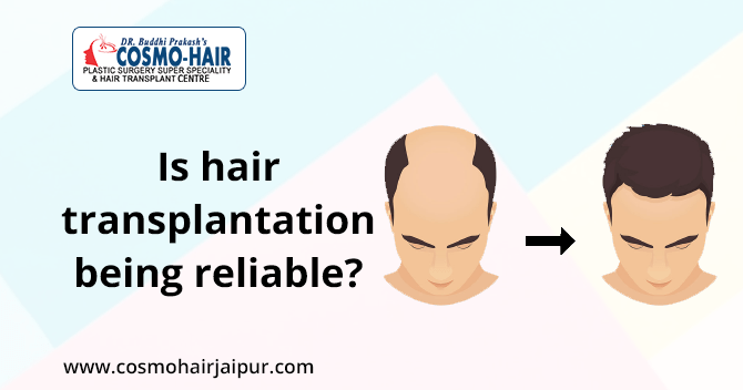 Is hair transplantation being reliable?