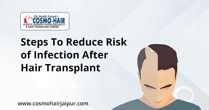 Steps To Reduce Risk of Infection After Hair Transplant Surgery.