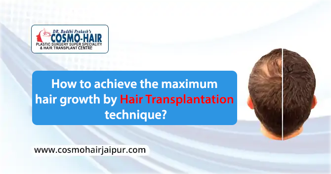 How to achieve maximum hair growth by hair transplantation?