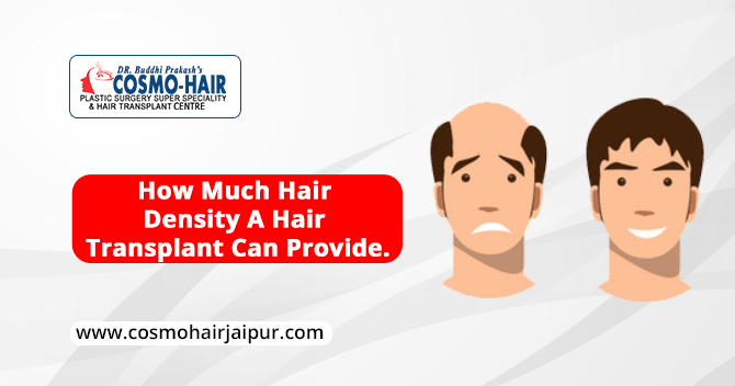 How much hair can density hair transplant provide?