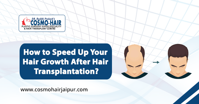 How to Speed Up Your Hair Growth After Hair Transplantation?