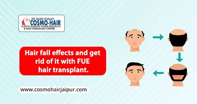 Hair fall effects and get rid of it with FUE hair transplant.