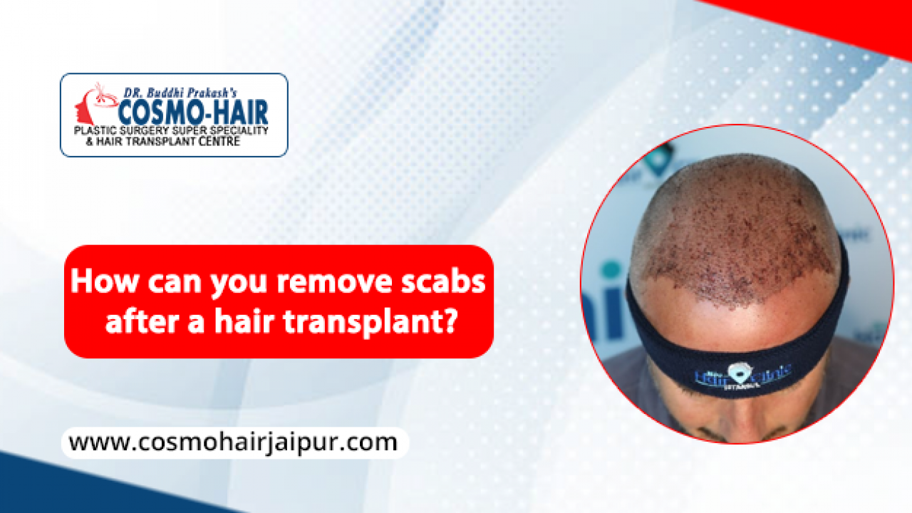 How can you remove scabs after a hair transplant? | Cosmo-Hair