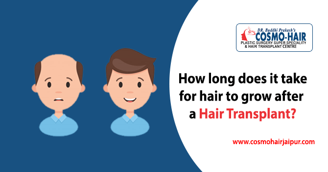 How long does it take for hair to grow after a hair transplant?