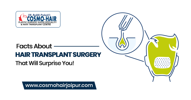 Facts About Hair Transplant Surgery That Will Surprise You!