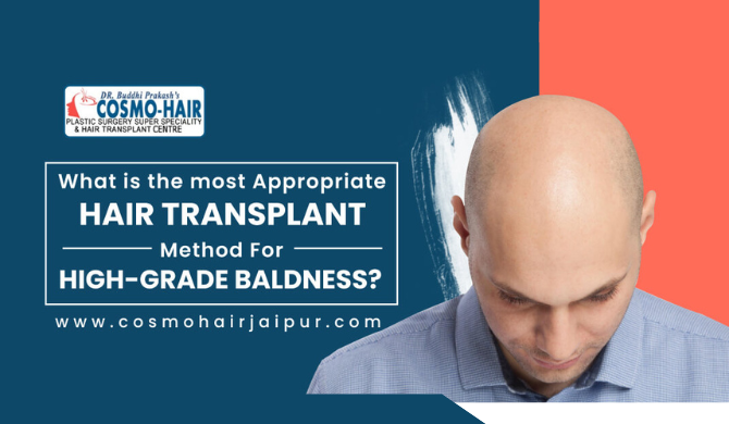 What is The Most Appropriate Hair Transplant Method for High-Grade Baldness?