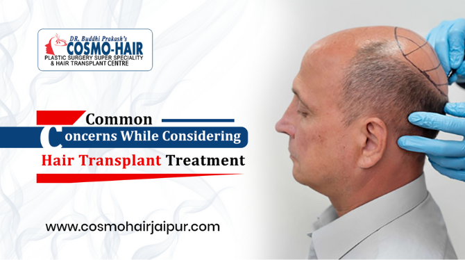 Common Concerns While Considering Hair Transplant Treatment!
