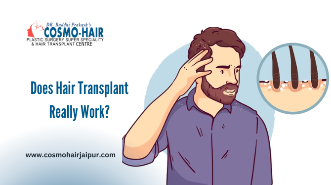 Does Hair Transplant Really Work?