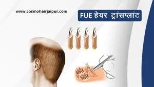 FUE हेयर ट्रांसप्लांट