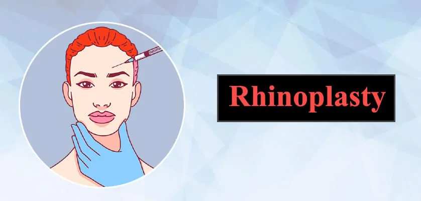 Rhinoplasty in Jaipur