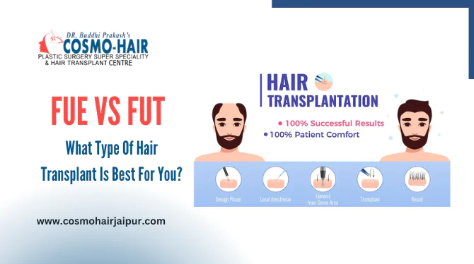 FUE VS FUT: What Type Of Hair Transplant Is Best For You?