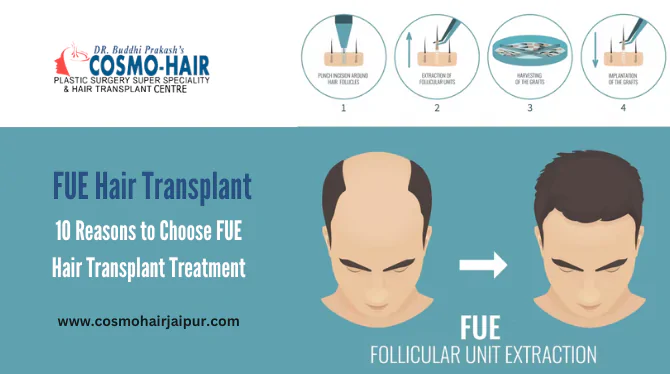 10 Reasons to Choose FUE Hair Transplant Treatment